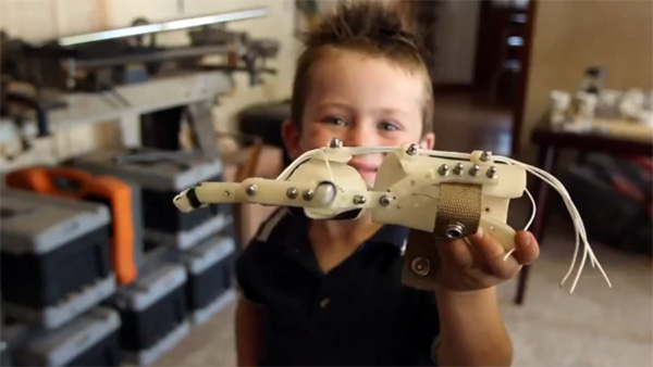 Мальчик держит протез руки напечатанный на 3D принтере